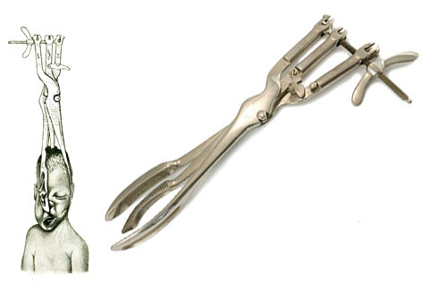 Seis Millones de abortos son también una&nbsp;pandemia.